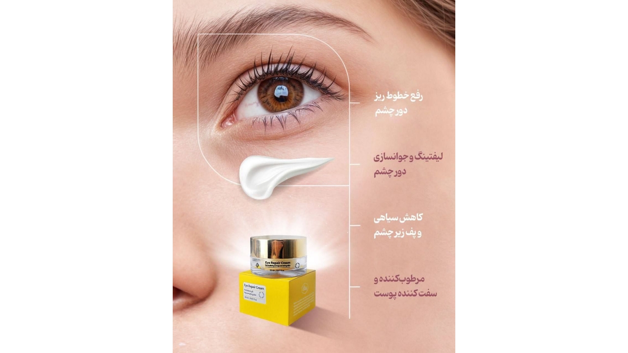 کرم دور چشم رویال